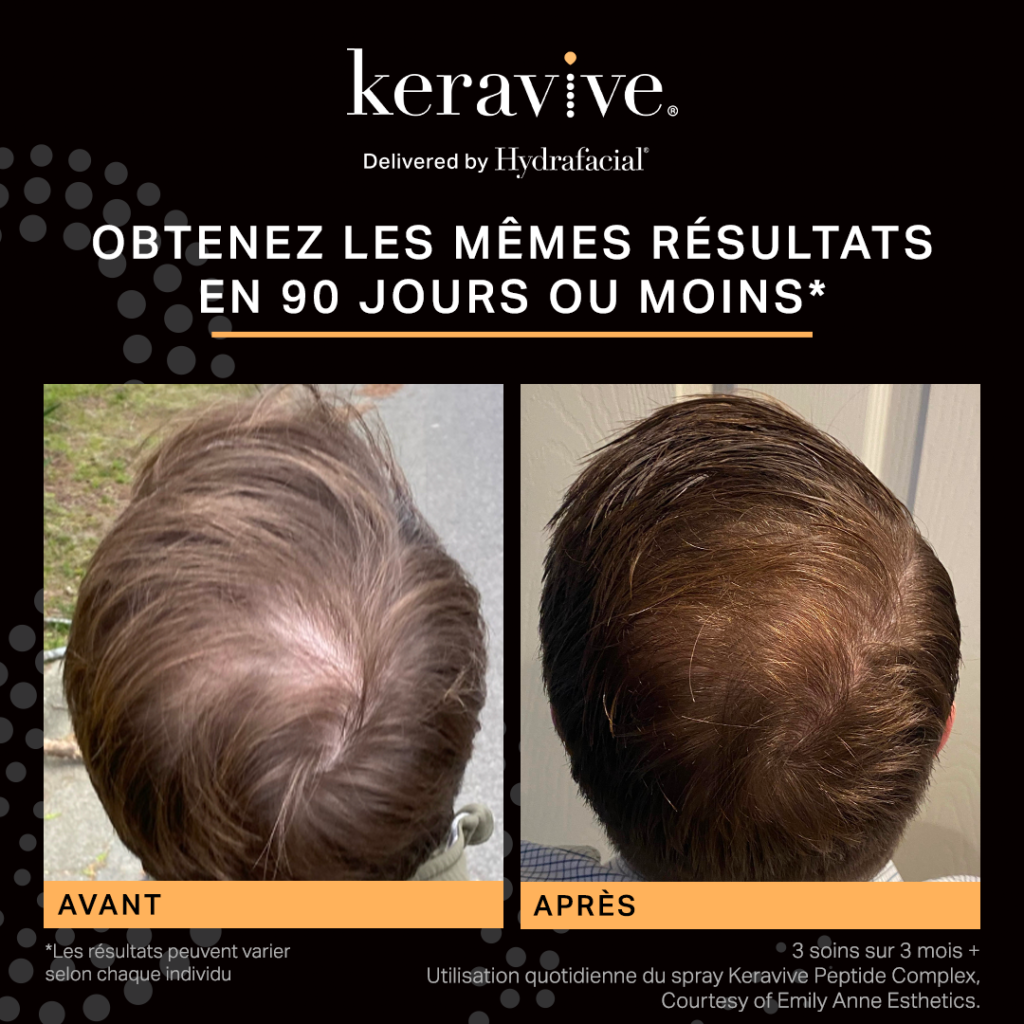 avant après soin hydrafacial cheveux keravive